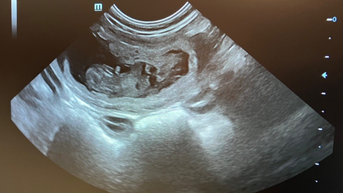 Snoope du LBDE est gestante